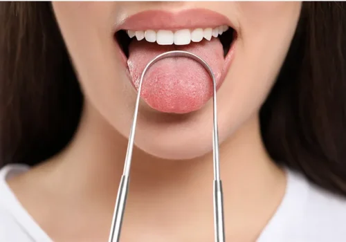 Matos Blog - A nyelv tisztítása szükséges vagy felesleges?